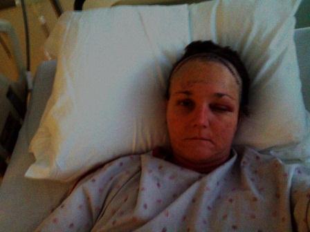 Picture of Kelly in the hospital after her second brain cancer surgery.