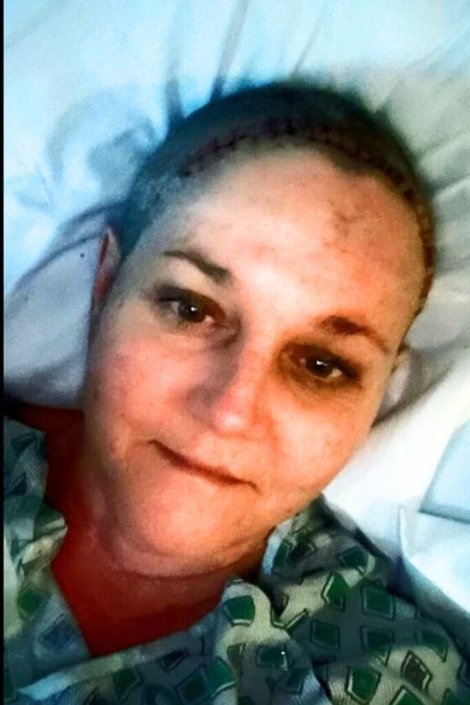 Kelly Swingle pictured after her third  brain cancer surgery in 2019